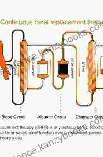 Replacement Of Renal Function By Dialysis